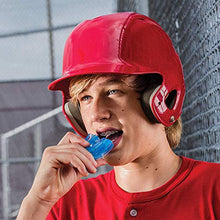 Load image into Gallery viewer, Shock Doctor Double Braces Mouth Guard – Upper and Lower Teeth Protection – Mouthguard No Boil / Instant Fit – For Youth, Teenager, Kids and Adults. Mouth Piece OSFA. Tether Strap Included